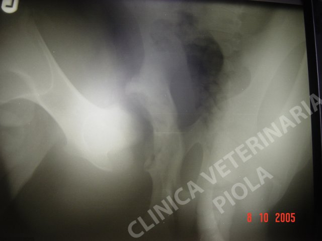 Artrite settica dell anca e osteomielite